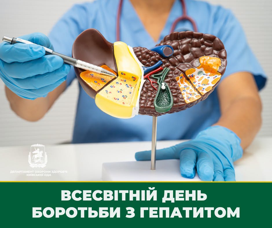 Медичний працівник у блакитному костюмі та синіх рукавичках тримає пластикову анатомічну модель печінки, підшлункової залози та жовчного міхура на металевій підставці. Рукою у верхньому лівому кутку медик вказує ручкою на внутрішню будову органу. У нижній лівій частині зображено білий логотип Департаменту охорони здоров'я Київської ОДА. На широкій темно-зеленій смузі внизу банера нанесено великий білий текст: «ВСЕСВІТНІЙ ДЕНЬ БОРОТЬБИ З ГЕПАТИТОМ».